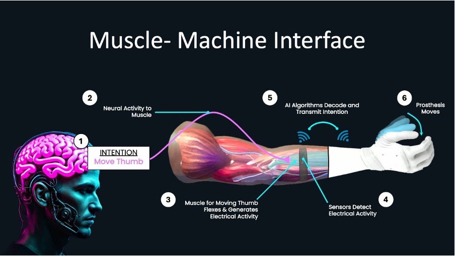 Diagram of the muscle-machine interface